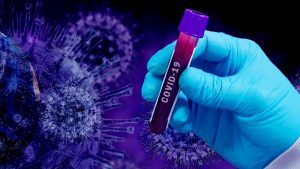 Masih Ada Daerah yang Enggan Kirim Sampel Spesimen, Ini yang Dikhawatirkan