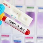 operasi yustisi padang