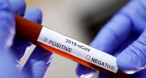 Total 17.379 Orang Warga Sumbar Terpapar Covid-19 Sampai Saat Ini