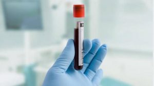 Laporan Sementara, 506 Warga Sumbar Positif Covid-19