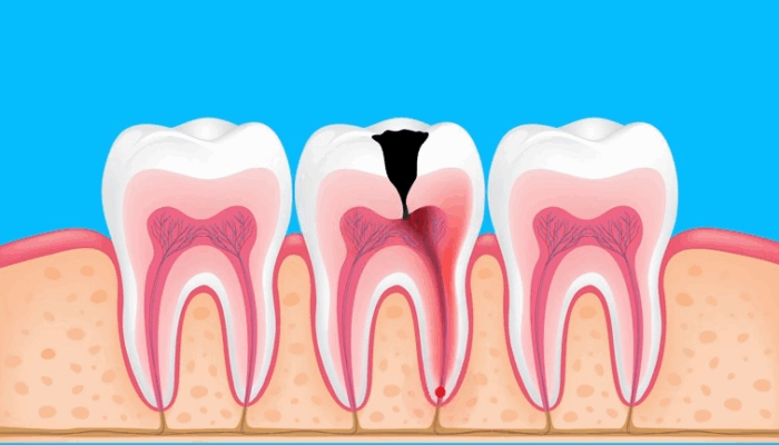 Hasil CKG, Warga Indonesia Banyak Sakit Gigi