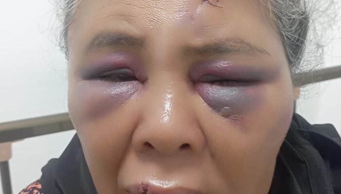 LBH Kecam Penganiayaan Terhadap Nenek Saudah (68 Tahun), Wajah Nyata dari Genosida Ekologi yang Dibiarkan