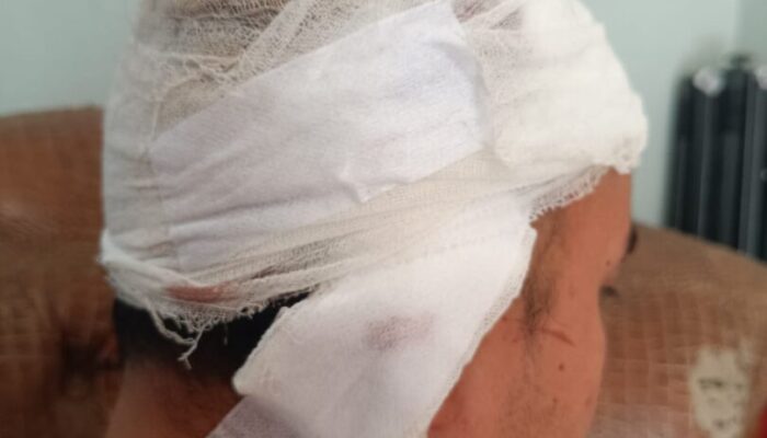 Tagih Hutang, Pemuda Ibuah Dikeroyok di Ompang Tanah Sirah, Kepala Robek 28 Jahitan